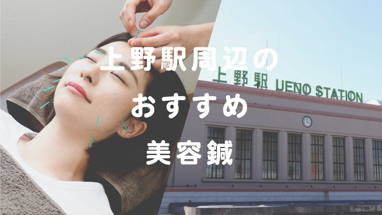 上野駅周辺で美容鍼が受けられるおすすめの鍼灸院のコラムのメインビジュアル