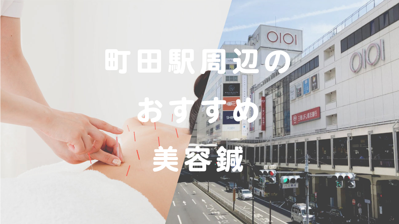 町田駅周辺のおすすめ美容鍼のコラムのメインビジュアル