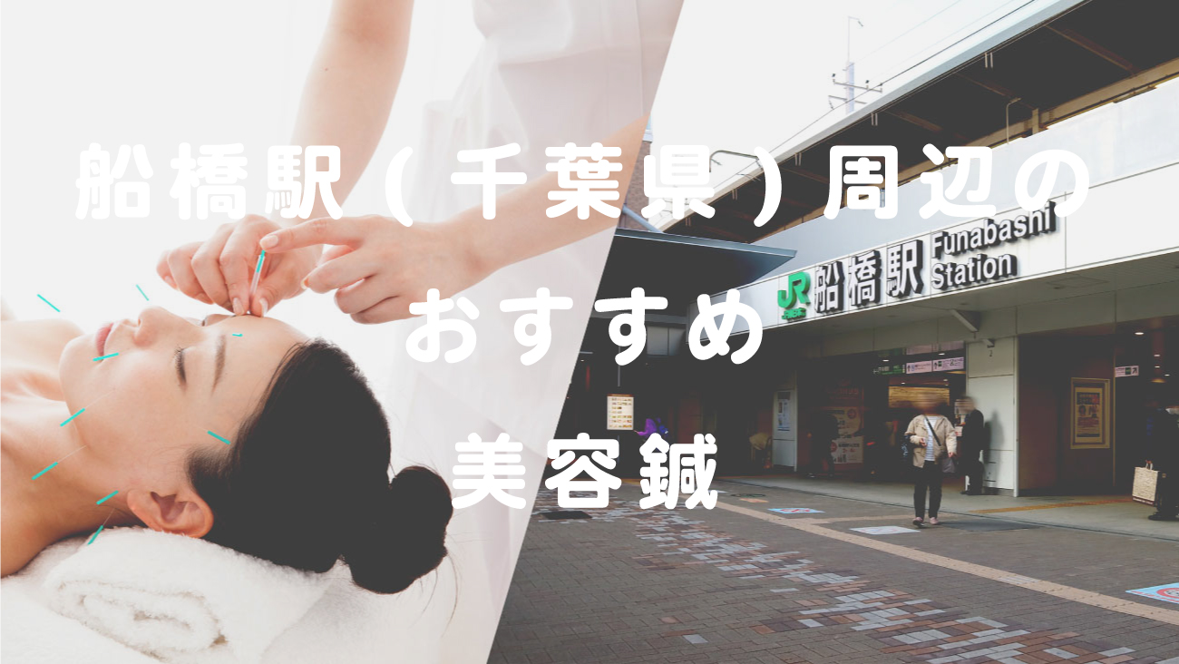 船橋駅(千葉県)周辺で美容鍼が受けられるおすすめの鍼灸院のコラムのメインビジュアル