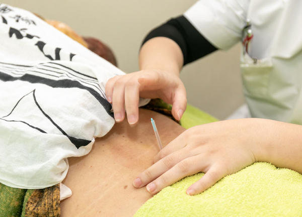 鍼灸整骨まこまないの施術風景画像(札幌市の鍼灸院(美容鍼)コラムのおすすめ画像)