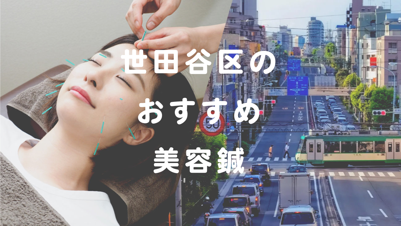 世田谷区で美容鍼が受けられるおすすめ鍼灸のコラムのメインビジュアル