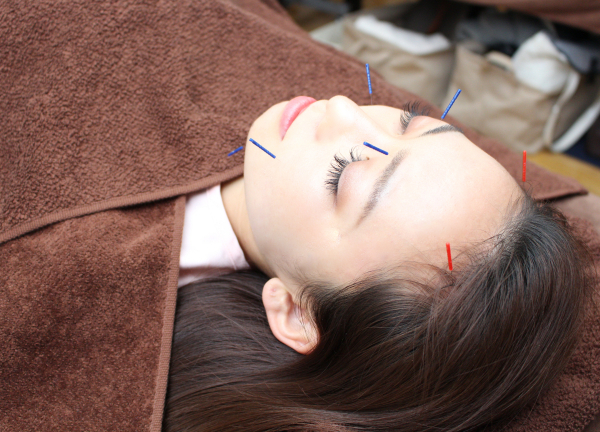 鍼灸サロンアイボリーローズのメインビジュアル(新宿駅の鍼灸院(美容鍼)コラムのおすすめ画像)