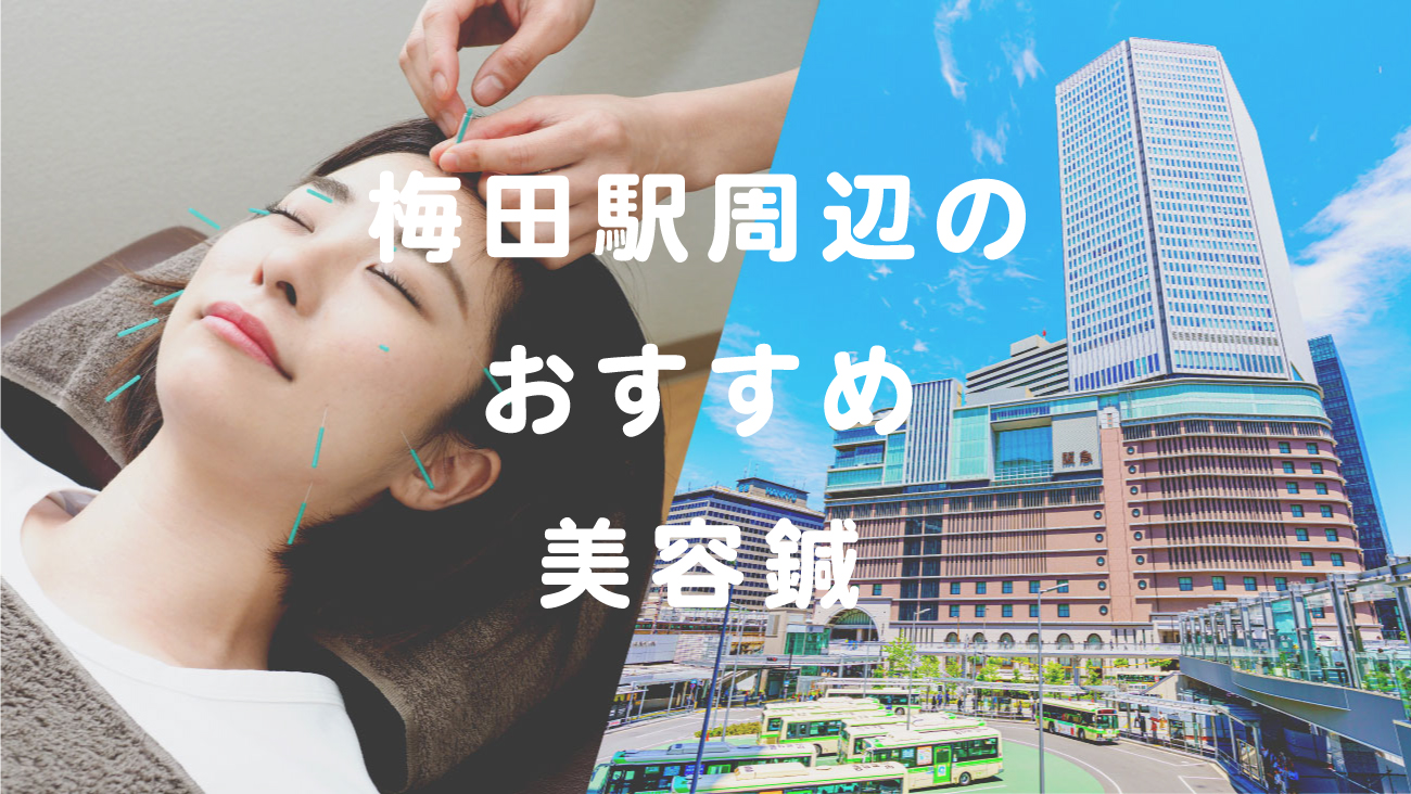 梅田駅周辺でおすすめの美容鍼が受けられる鍼灸院のコラムのメインビジュアル