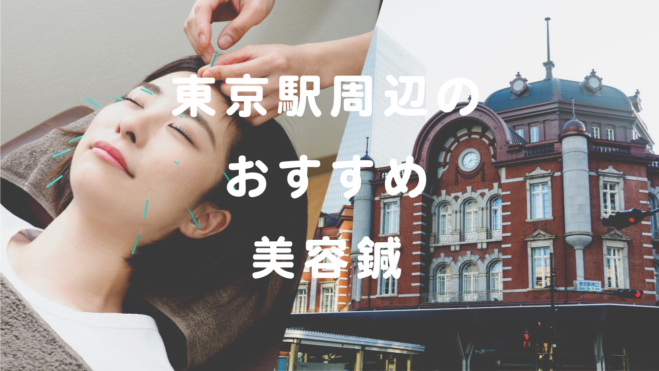 東京駅周辺で美容鍼が受けられるおすすめの鍼灸のコラムのメインビジュアル