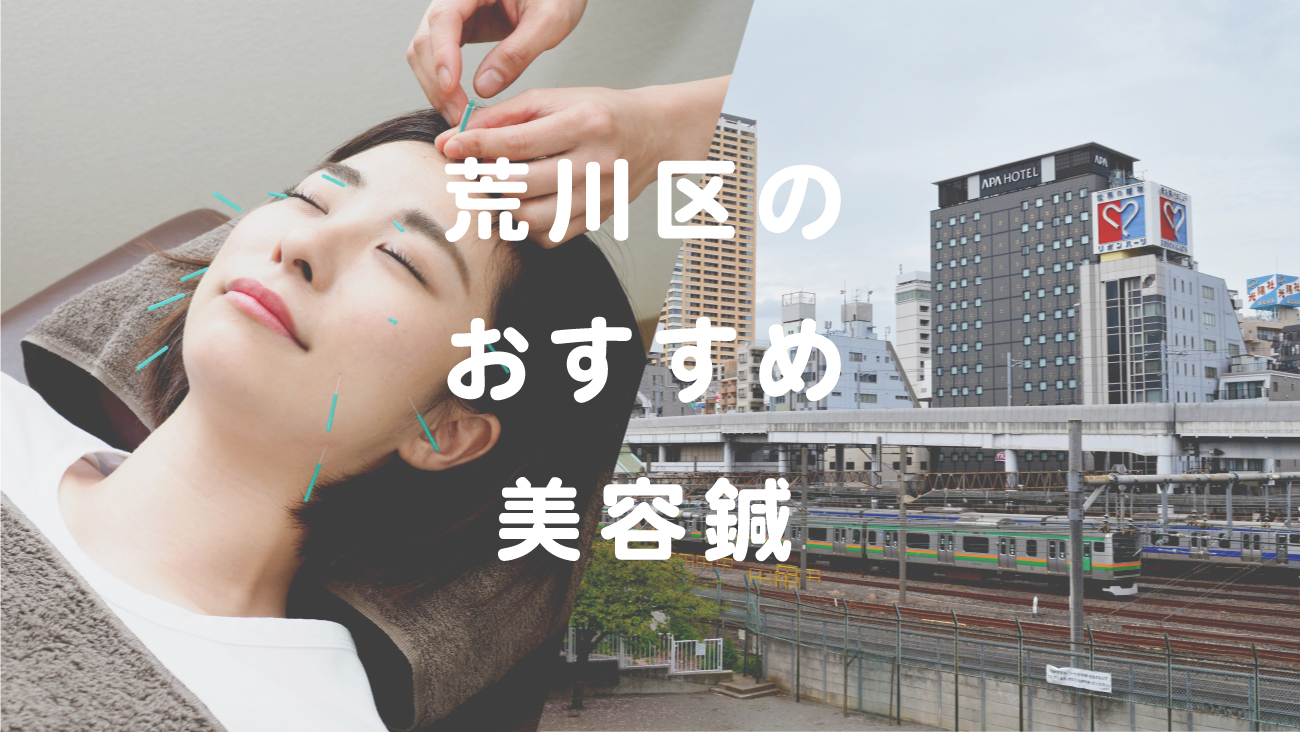 荒川区で美容鍼が受けられるおすすめの鍼灸院のコラムのメインビジュアル