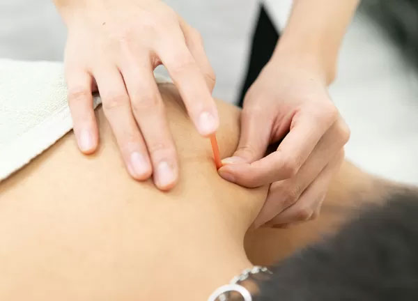 みずほ台ワイズ鍼灸接骨院の施術画像3(埼玉県の鍼灸院コラムのおすすめ画像)