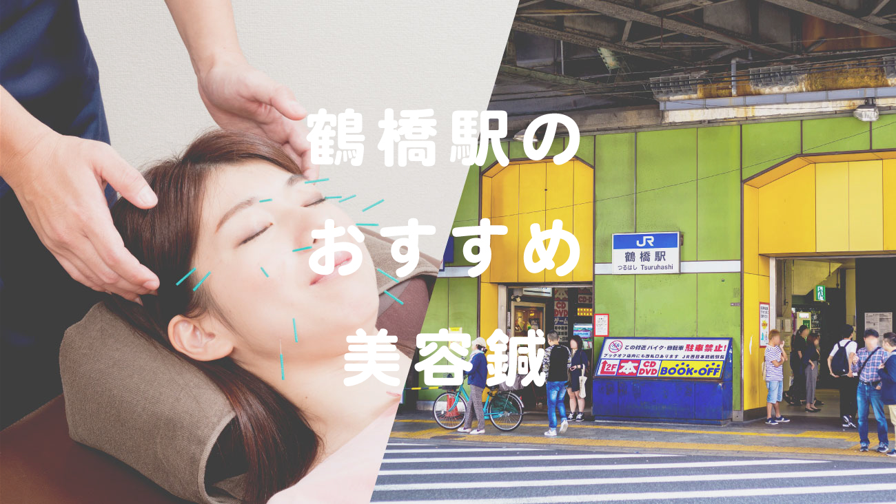 鶴橋駅周辺で口コミが評判のおすす鍼灸院のコラムのメインビジュアル
