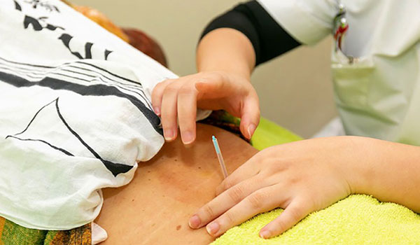 厚別鍼灸整骨院の施術風景画像02(札幌市の鍼灸院コラムのおすすめ画像)