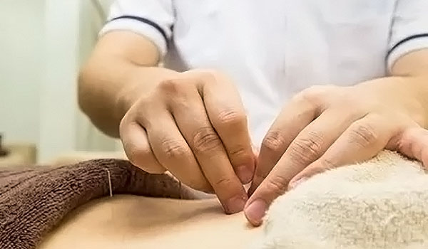 ゆずりは鍼灸整骨院の施術風景画像(大阪市の鍼灸院コラムのおすすめ画像)