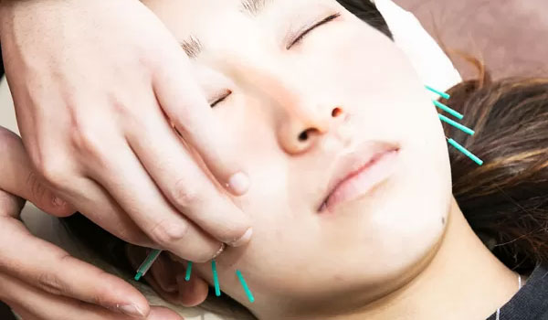 ＷＩＮＧ鍼灸整骨院の施術風景画像05(堺市の美容鍼コラムのおすすめ画像)